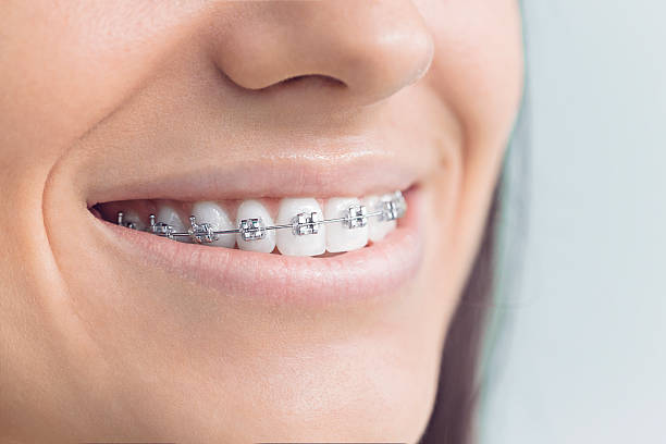 Best Teeth Whitening  in Bellefonte, PA